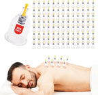 [100 Pack] Bulk Cupping Set for Massage Therapy - B1 B2 B3 B4 B5 B6 B7 U4 U5 - B6 (1.33 in) - Wholesale Professional Cupping Therapy Set, Cuppings Massage Kit, Physical Therapy Kit [No Pump Included]
