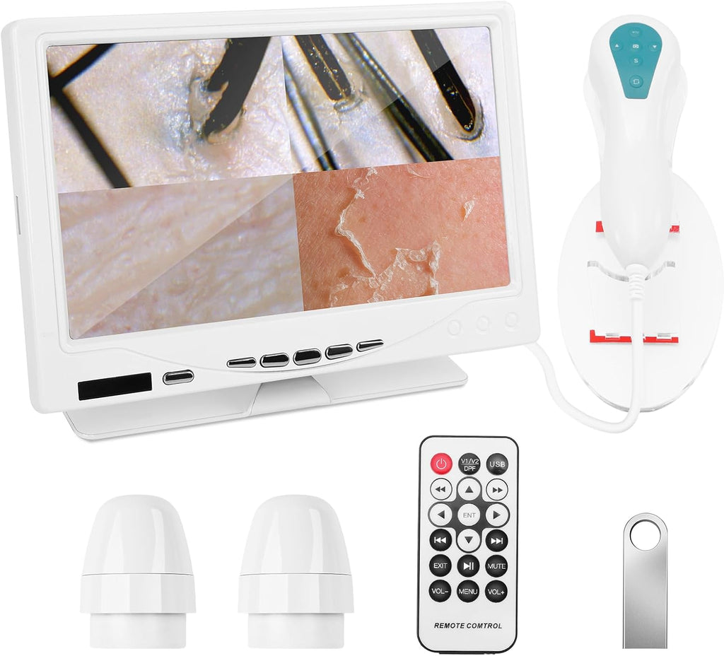 Beauty Star 7-Inch Scalp & Skin Analyzer with 50X/200X Dual Lenses, 4-Split View & 16GB Storage – HD Trichology Microscope Camera for Professional Salon, Head Spa, and Home Hair Follicle Health