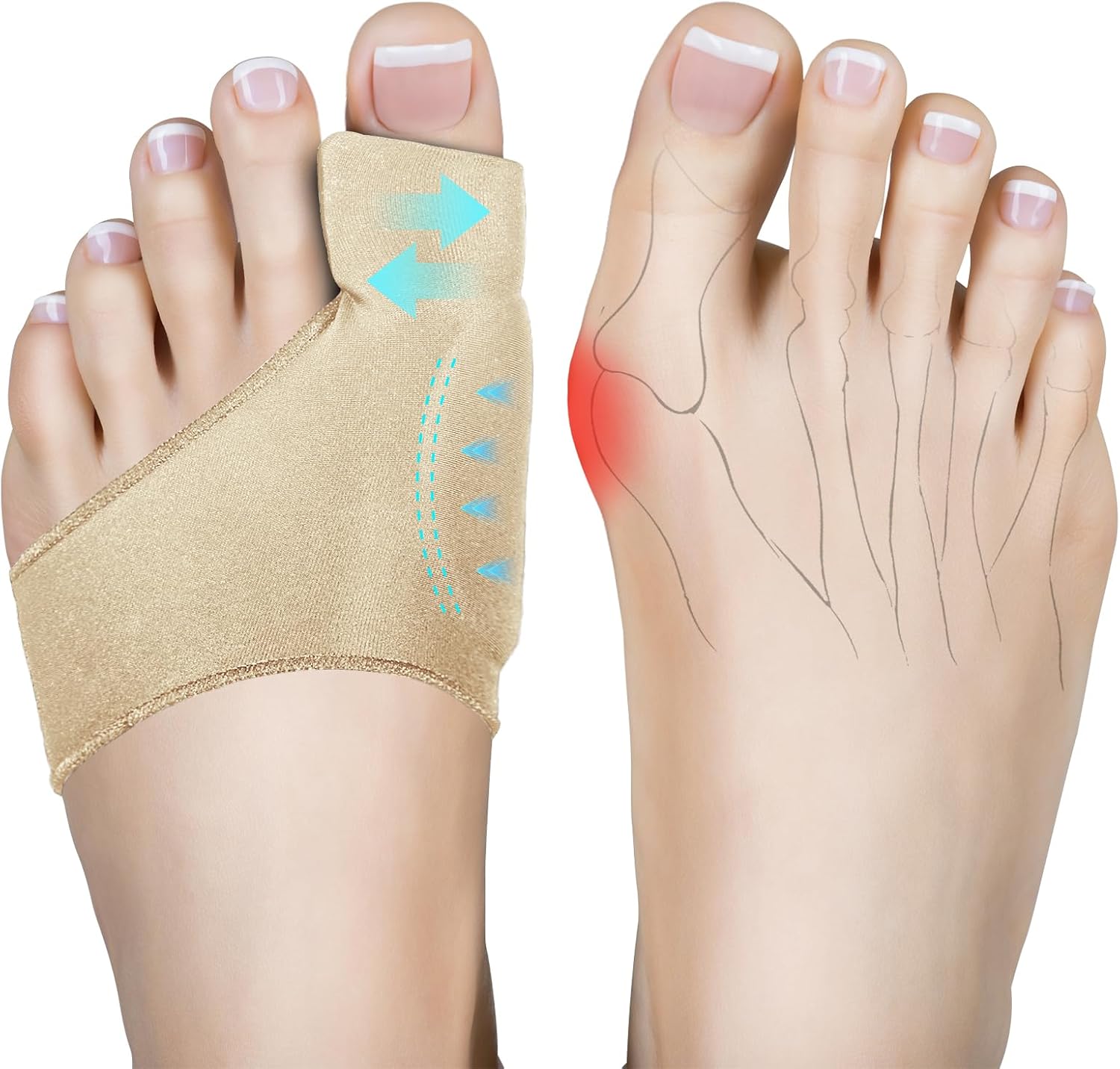 Bunion Corrector for Hallux Valgus - Big Toe Straightener & Bunion Splint for Overlapping Big Toes, Instant Bunion Relief & Pain Relief, Comfortable Breathable Fabric for All-Day Wear(Khaki 2-Pack) (Large)