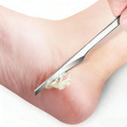 Stainless Steel Foot Files Callus Removers 2Pcs Pedicure Kit Skin Scraper for Men and Women Durable Foot Care Tools for Hard Skin Removal