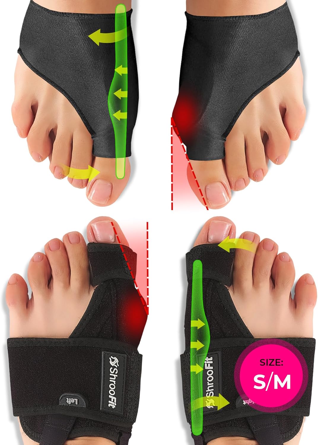 Effective Corrector for Women and Men | Relief Kit, Straighten Toes, and Correct Alignment | Cushion Sleeves | Feet Support - Small/Medium